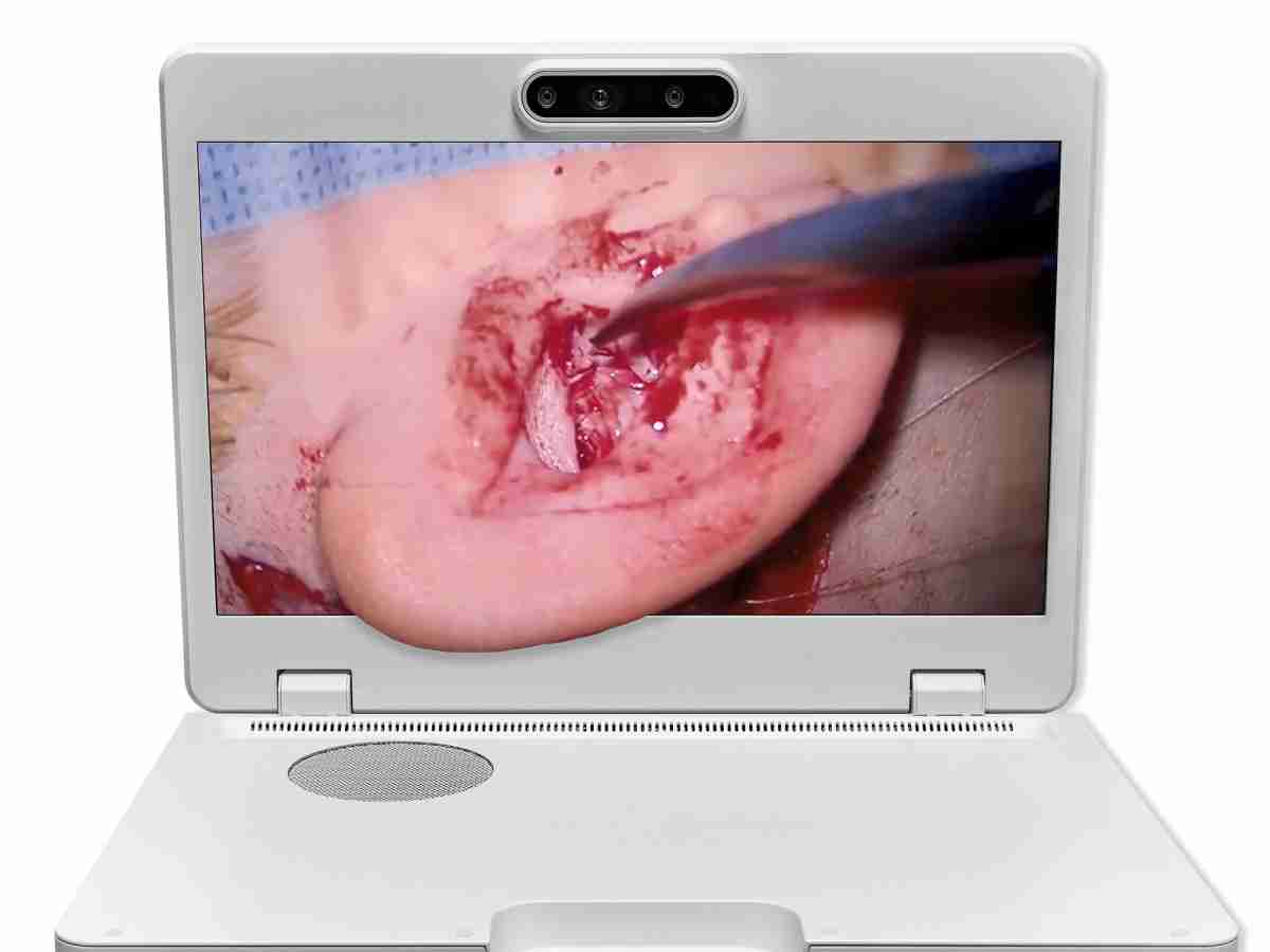 达擎之＂Heads-up 3D显微手术显示系统＂，，，，整合4K裸眼3D显示及眼球追踪系统，，具备快速追踪人眼移动位置功能，，，减轻医师长时间维持固定姿势的负担，，，，让医师能有更宽广清晰的3D立体视野及更舒适的姿势来执行手术。。。